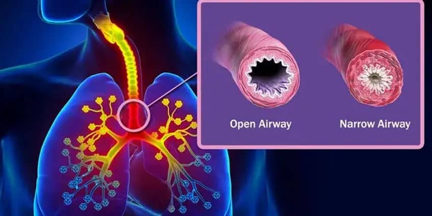 Biomagnetism_Asthma-2