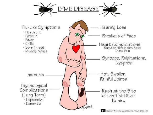 biomagnetism-and-lyme-disease-multi-pathogen-syndrome-blog-1